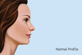Normal Profile